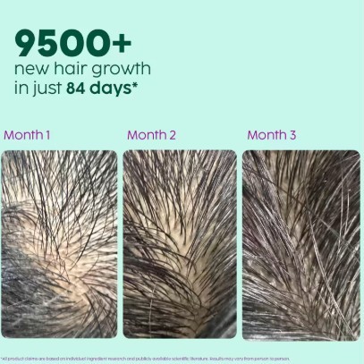 Plix Rosemary Hair Growth Serum